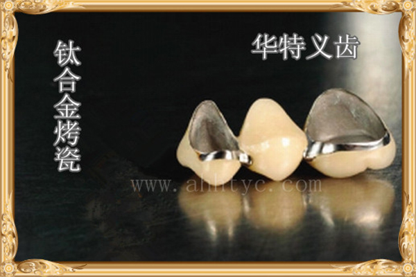 钛合金烤瓷 